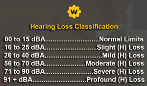 Hearing loss chart