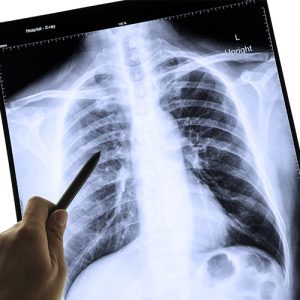 Respiratory Illnesses - Worksite Medical