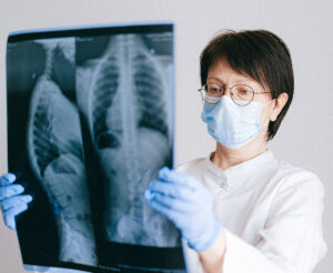 Sarcoidosis - medical professional checking on lung xray