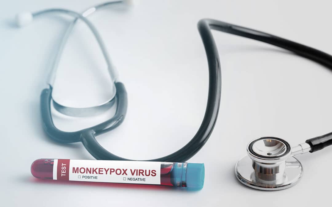 How to protect your team from monkeypox in the workplace