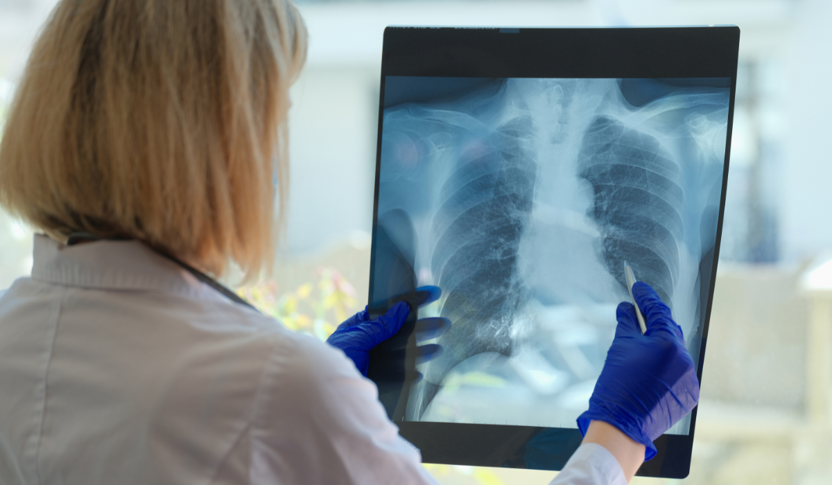 A female doctor holds up a chest xray to help diagnose any diseases, like COPD in the workplace