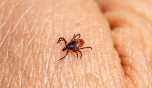 A photo of a tick on a person's skin. Preventing Wildlife-Related Workplace Injuries